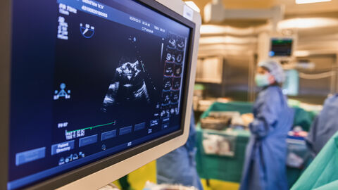 Für viele Arbeitsprozesse sind inzwischen große Datenmengen erforderlich, die sich nur mit einer schnellen Internetanbindung realisieren lassen: wie hier, mobile Ultraschallgeräte.