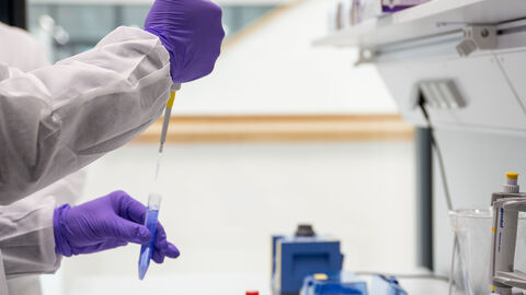 Eine Person hält eine Pipette in ein Reagenzglas